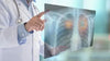 Floor-Mounted X-ray Vs Ceiling-Mounted X-ray Rooms