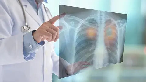 Floor-Mounted X-ray Vs Ceiling-Mounted X-ray Rooms