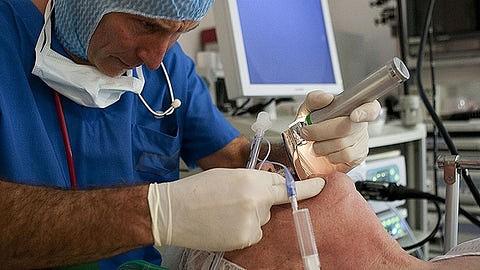 Intubation Scope - Types and Uses
