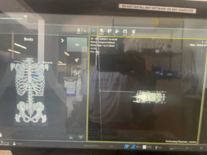 GE AMX 4 Plus with DR Retrofit Vivix S - PT Medical Technologies