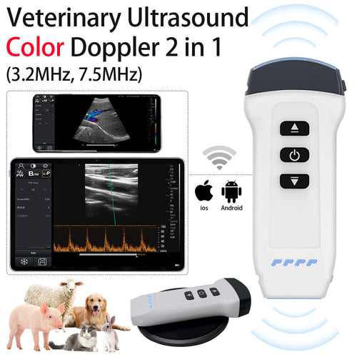 Philips Diagnostic Ultrasound System w/ Probes