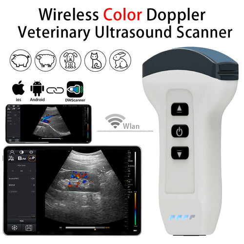 Philips Diagnostic Ultrasound System w/ Probes