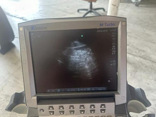 Sonosite M-Turbo