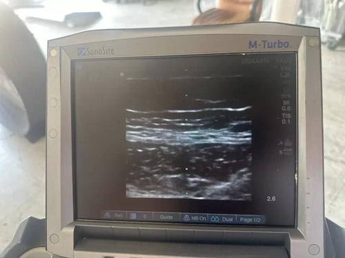 Sonosite M-Turbo
