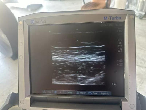 Sonosite M-Turbo