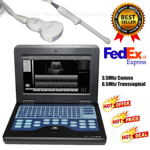 Sonosite M-Turbo