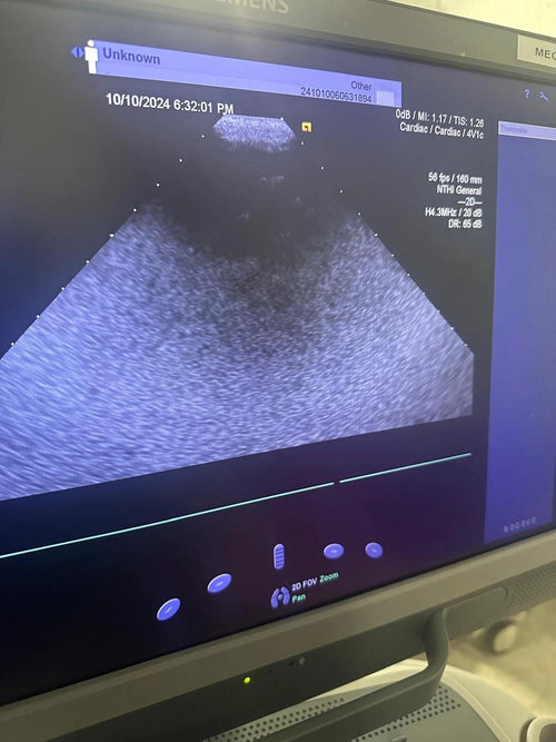 2019 Siemens Acuson S2000 with 8V3 , 4V1c, 10V4  Probes