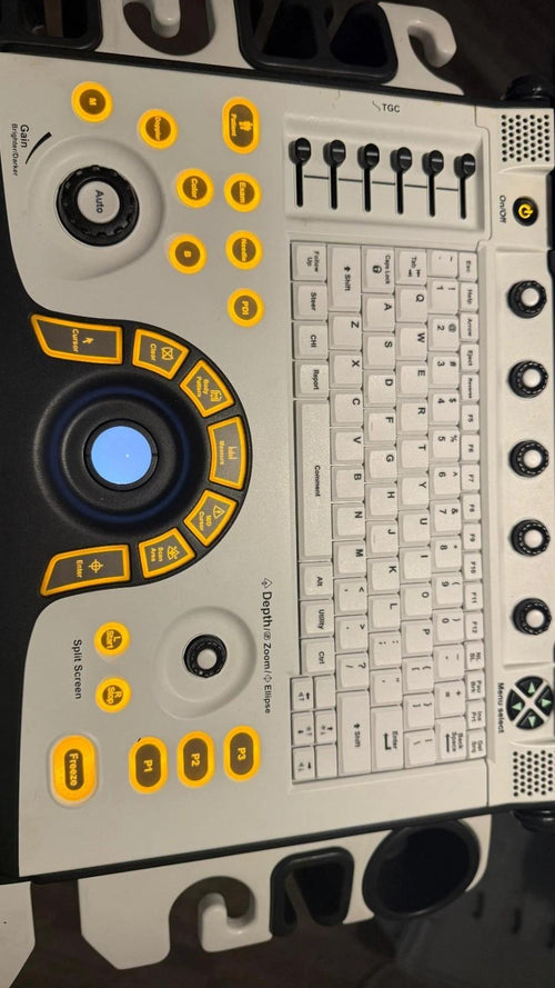 2018 Refurbished GE Logiq E ultrasound with  convex L4-12t Or L10-22 Transducer