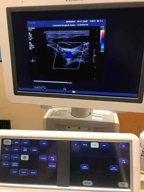 PHILIPS Ultrasound  IE33 "R" CART