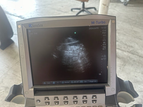 Sonosite M-Turbo Ultrasound System w/ L25 & P21 ProbeS w/ Power Supply & CART