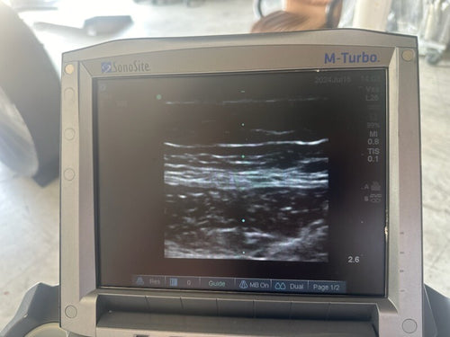 Sonosite M-Turbo Ultrasound System w/ L25 & P21 ProbeS w/ Power Supply & CART