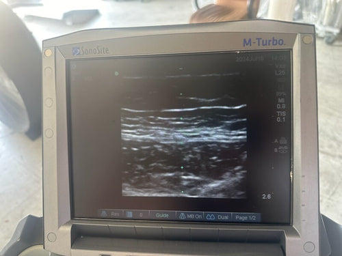 Sonosite M-Turbo Ultrasound System w/ L25 & P21 ProbeS w/ Power Supply & CART