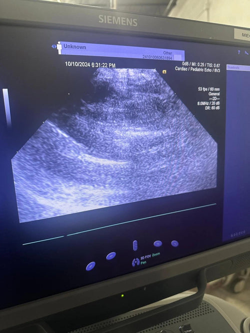 2019 Siemens Acuson S2000 with 8V3 , 4V1c, 10V4  Probes