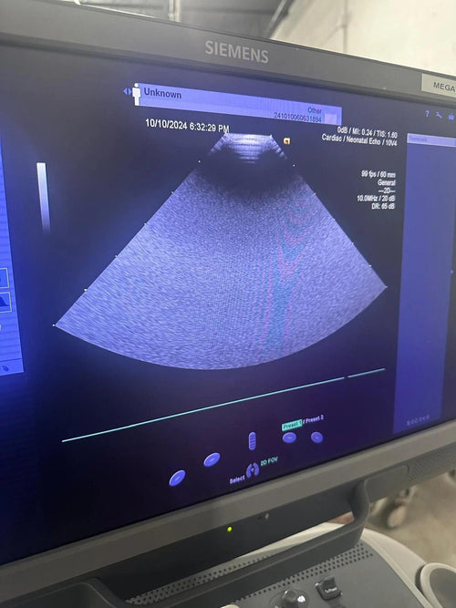 2019 Siemens Acuson S2000 with 8V3 , 4V1c, 10V4  Probes