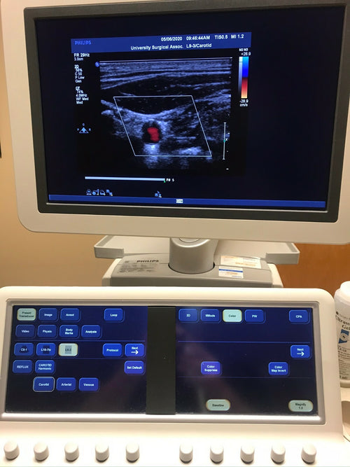 PHILIPS Ultrasound  IE33 "R" CART