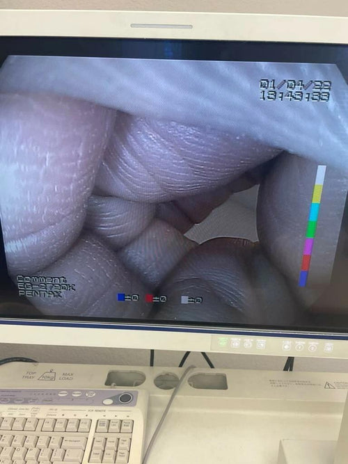 Pentax EC-3490LK Colonoscope Endoscope Endoscopy(1315-S13)_