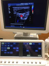PHILIPS Ultrasound  IE33 "R" CART