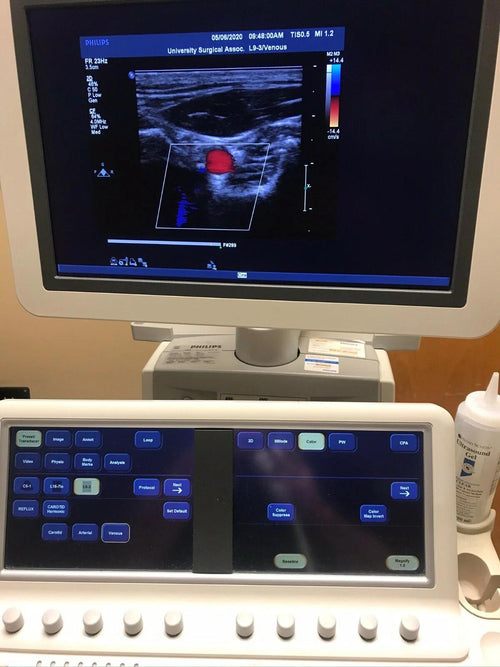 PHILIPS Ultrasound  IE33 "R" CART
