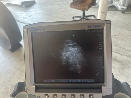 Sonosite M-Turbo Ultrasound System w/ L25 & P21 ProbeS w/ Power Supply & CART