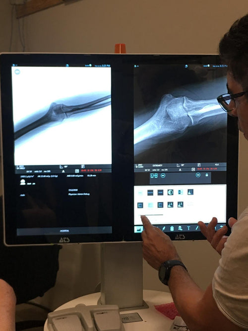 OrthoScan FD-Pulse Mini C-Arm Imaging System